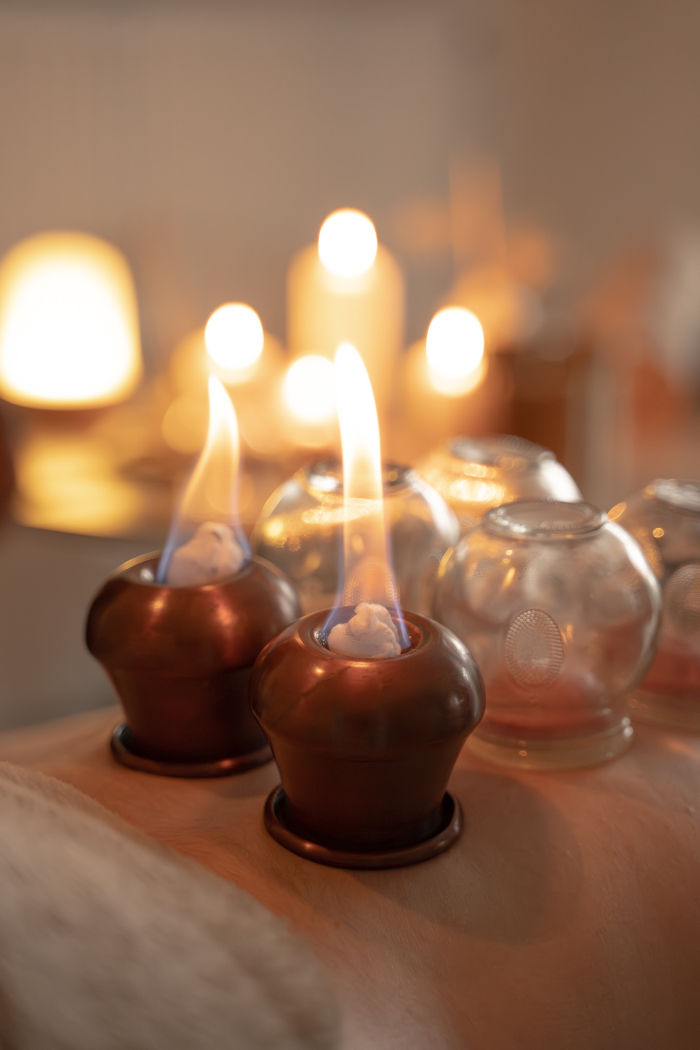 Cupping Thérapie — AG Therapy