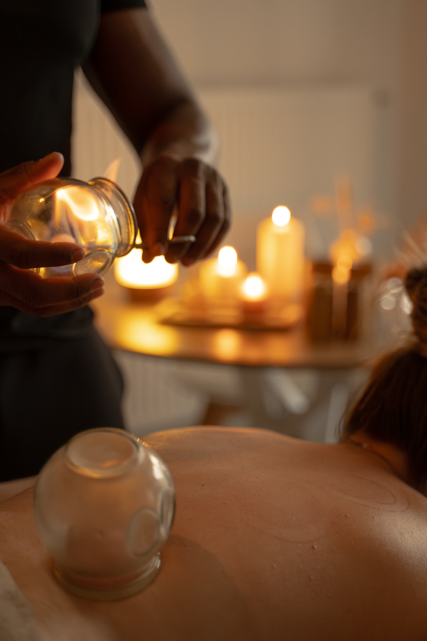 Cupping Thérapie — AG Therapy